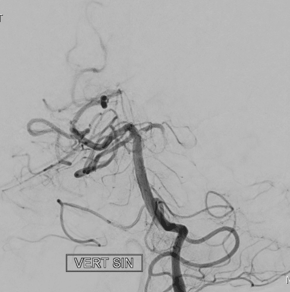 case 1 pre-treatment
